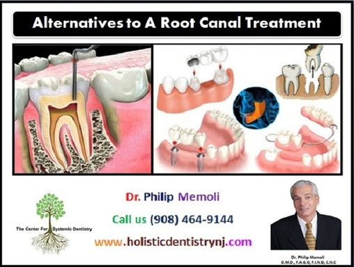 root-canal-alternative-holistic-dentistry.jpg