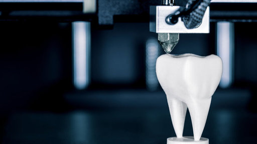 The Future of Tooth Replacement How 3D Printing is