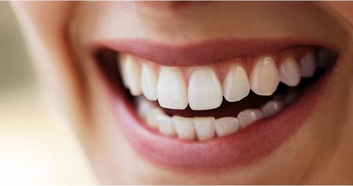 How-Long-Does-Full-Mouth-Reconstruction-Take.jpg
