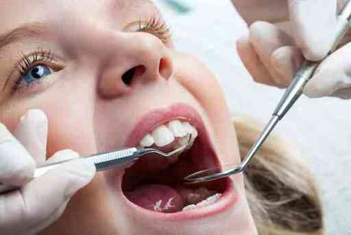 3 Different Types of Cavities and How They Can Be