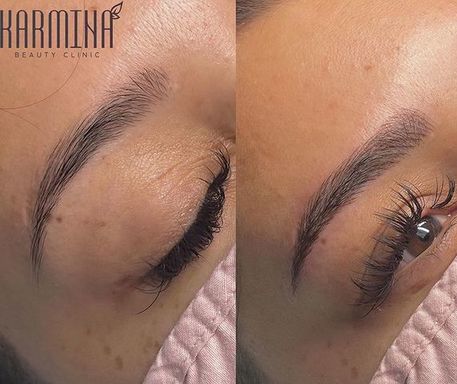 Before and After Microblading