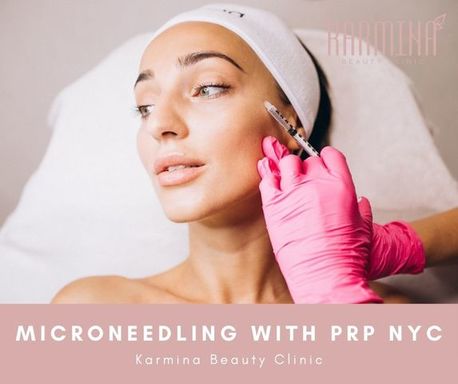 Microneedling with PRP NYC.jpg