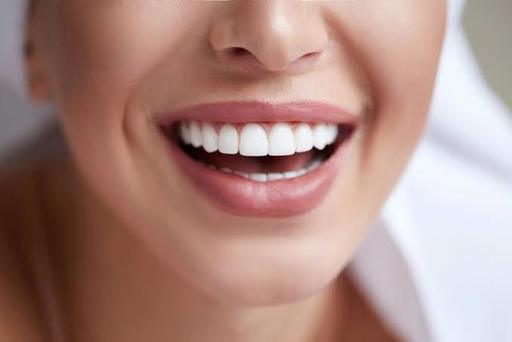 10 Questions to Ask Your Cosmetic Dentist.jpg