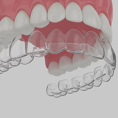 Invisalign-1.jpg